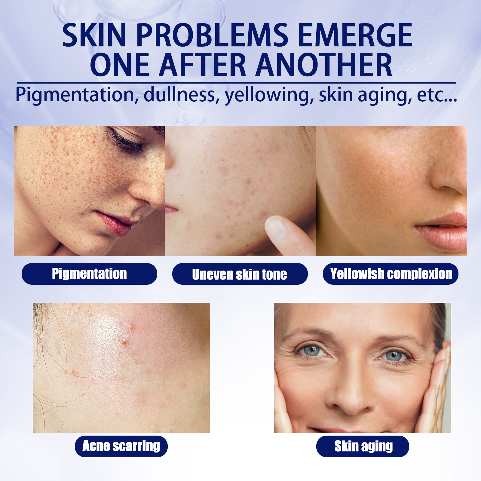EELHOE Anti-aging Vitamin C Facial Essence, Reduces Spots Acne Fine Lines, Moisturizes Facial Essence - Image 4