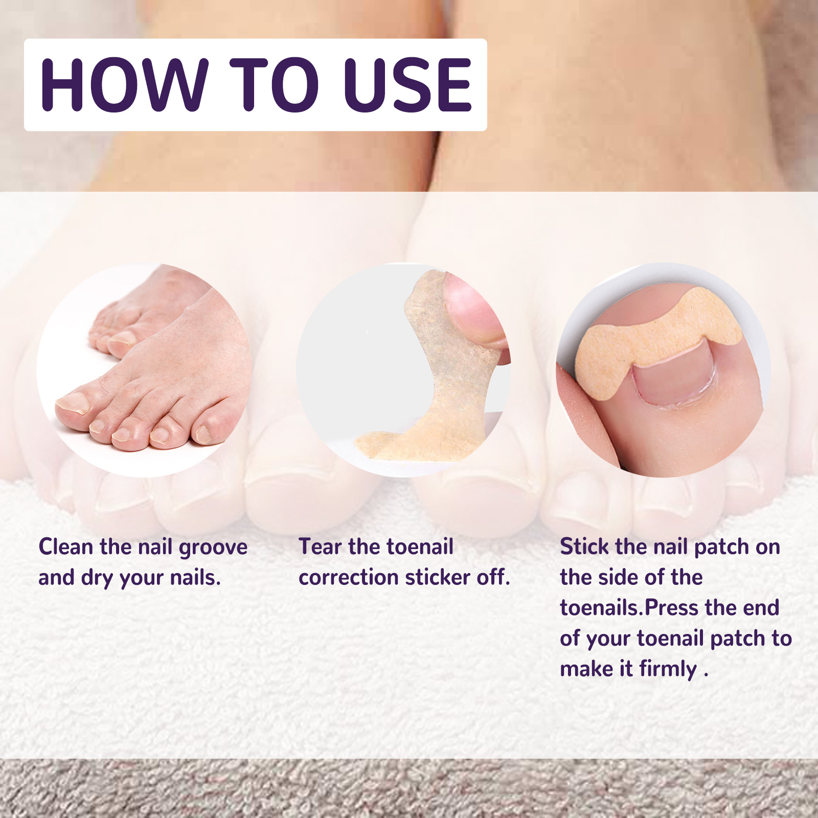 Elastic Toenail Correction Patch, Nail Groove Correction Nail Repair Ingrown Nail Patch - Afbeelding 7