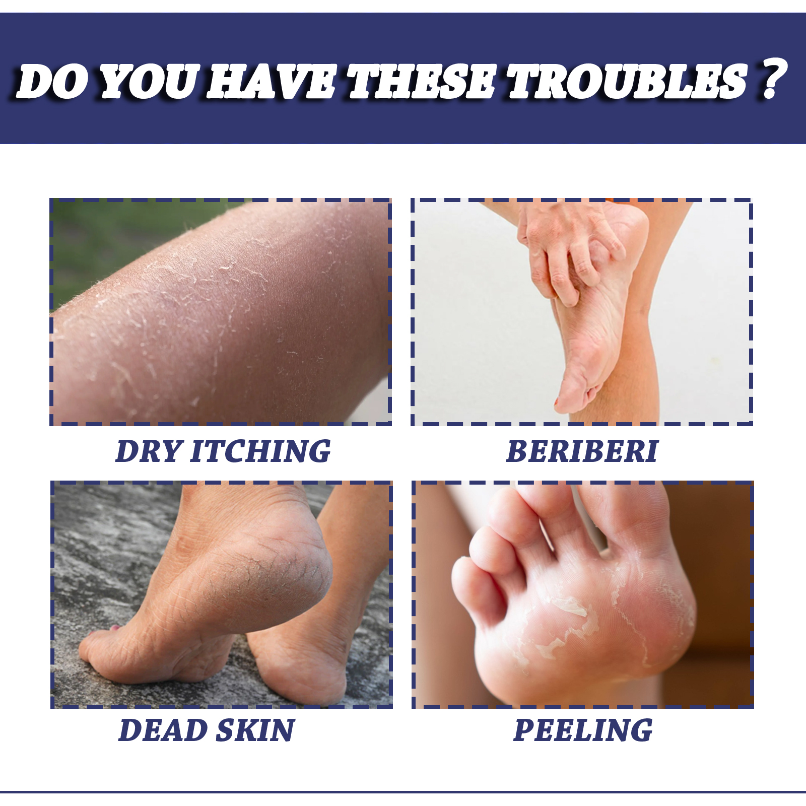 South Moon Urea Hand And Foot Cream, Anti-Crack Peeling Repair Skin Crack Dry Moisturizing Skin Soothes Skin - Image 3