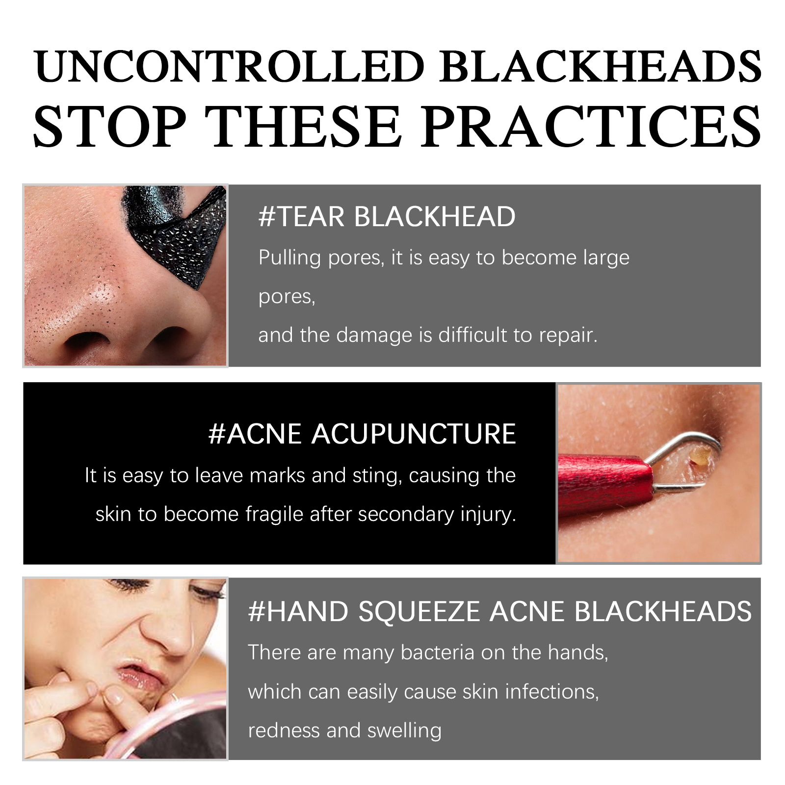 EELHOE Blackhead Removal Mask Cleanses Blackheads, Lighens Pimples, Tighteners Pores And Controls Oil Smear Mask - Image 3