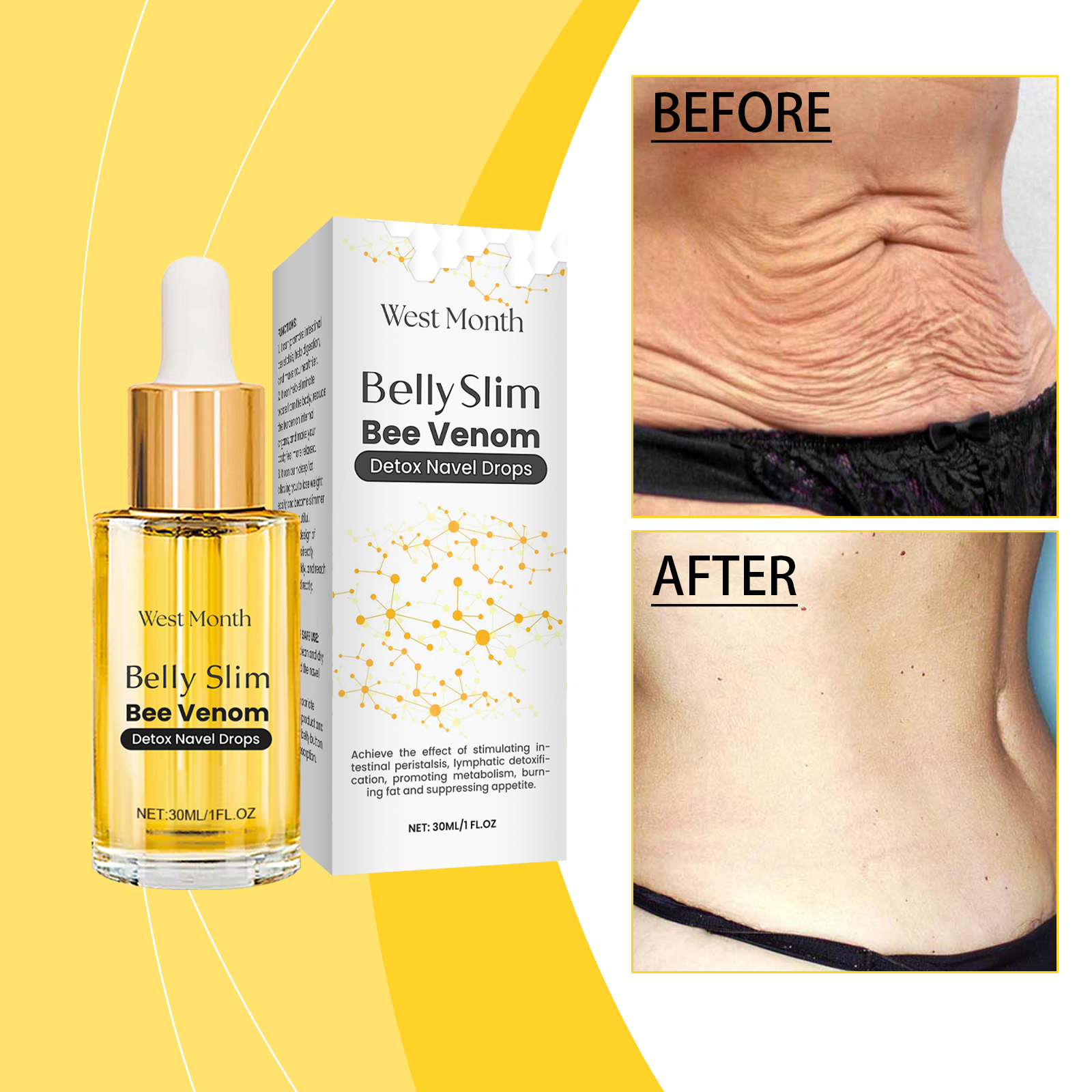West&Month Bee Venom Body Care Essence, Gently Nourishing And Firming Body Skin Care Essence - Image 2