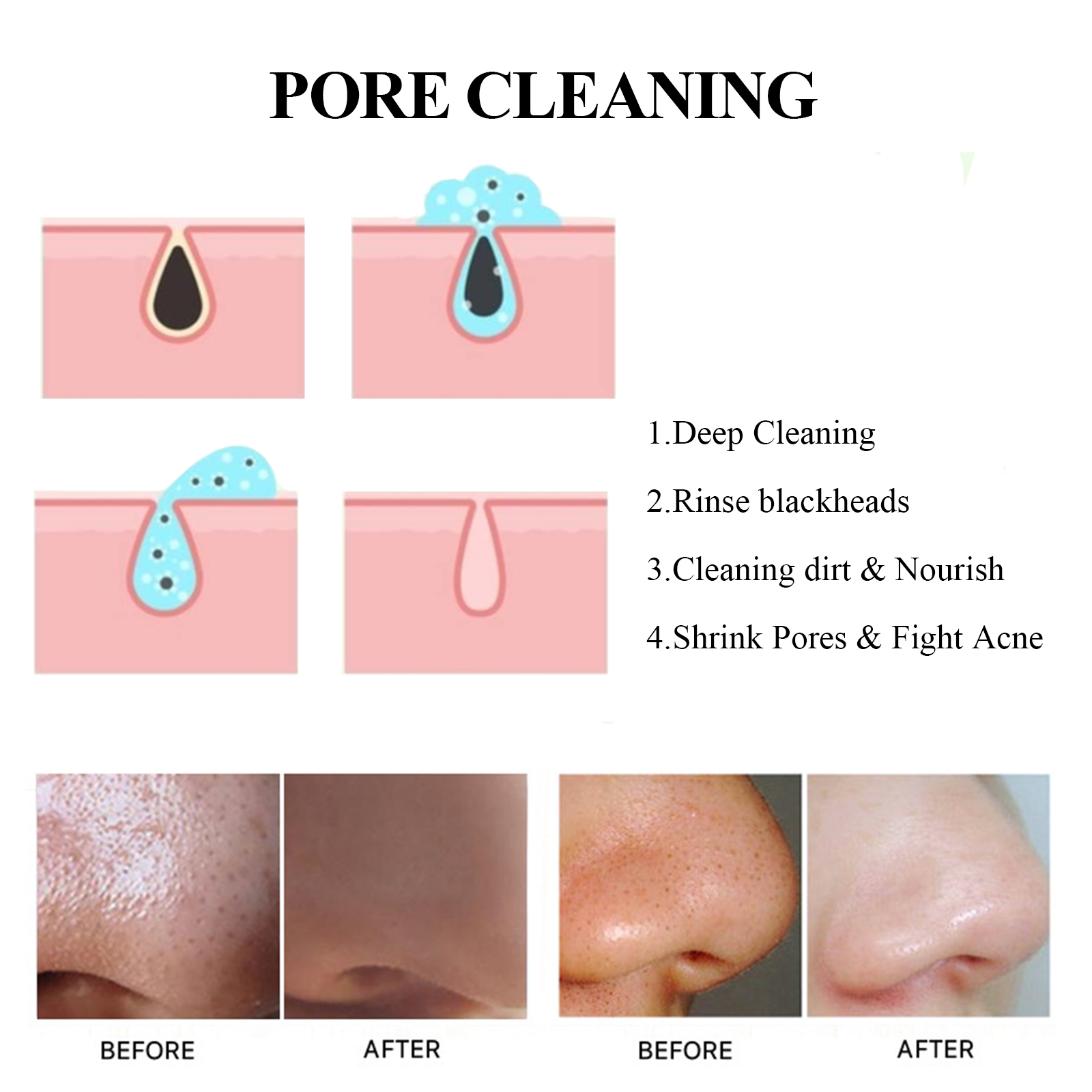 EELHOE Blackhead Removal Mask Deeply Cleanses Pores, Lightening Blackheads, Oil Control And Moisturizing Smear Peel Mask - Image 4