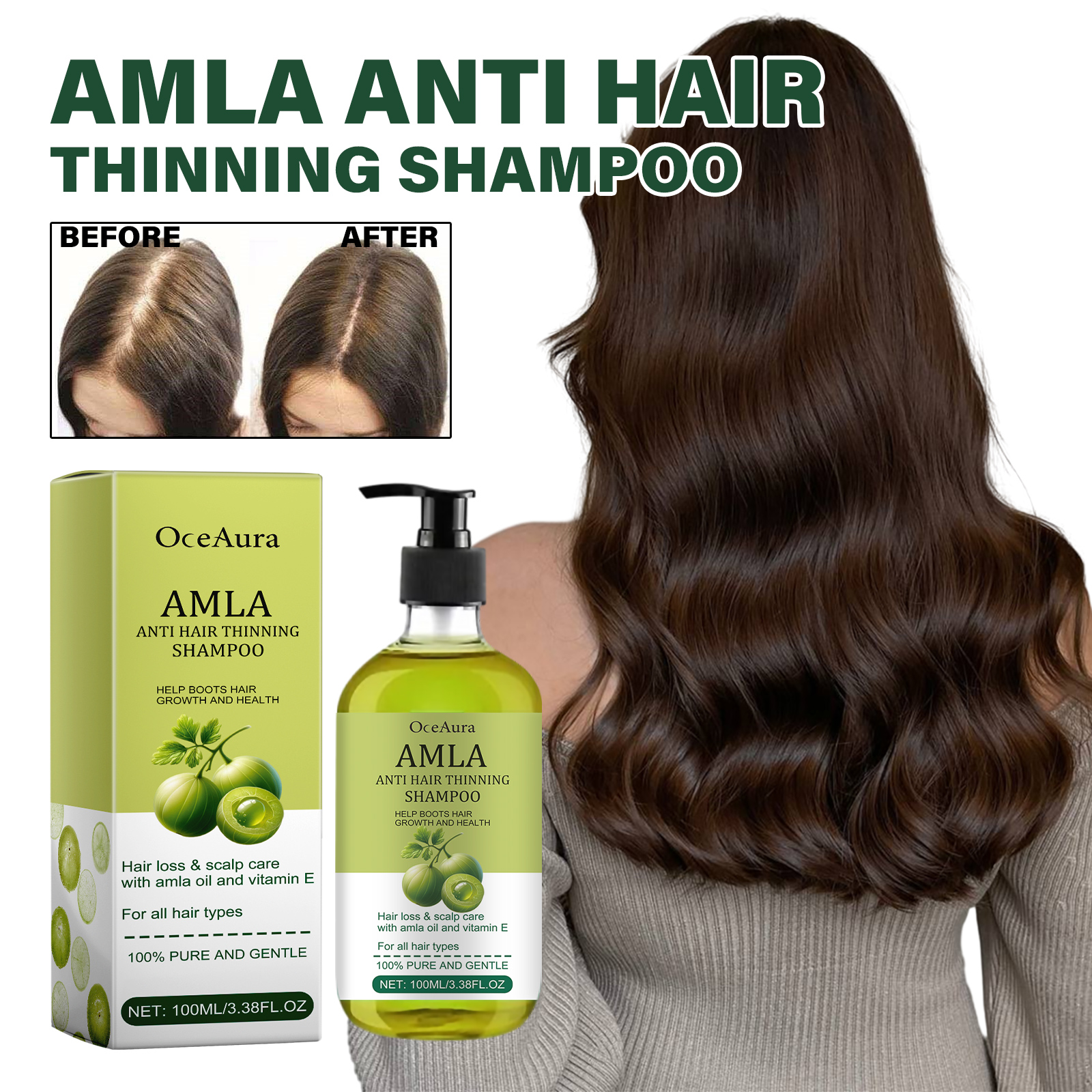 Amla Anti Hair Thinning Shampoo, Scalp Cleanness Moist Smooth Shiny Hair, Dense Hair Wash Protect Suits - Image 3