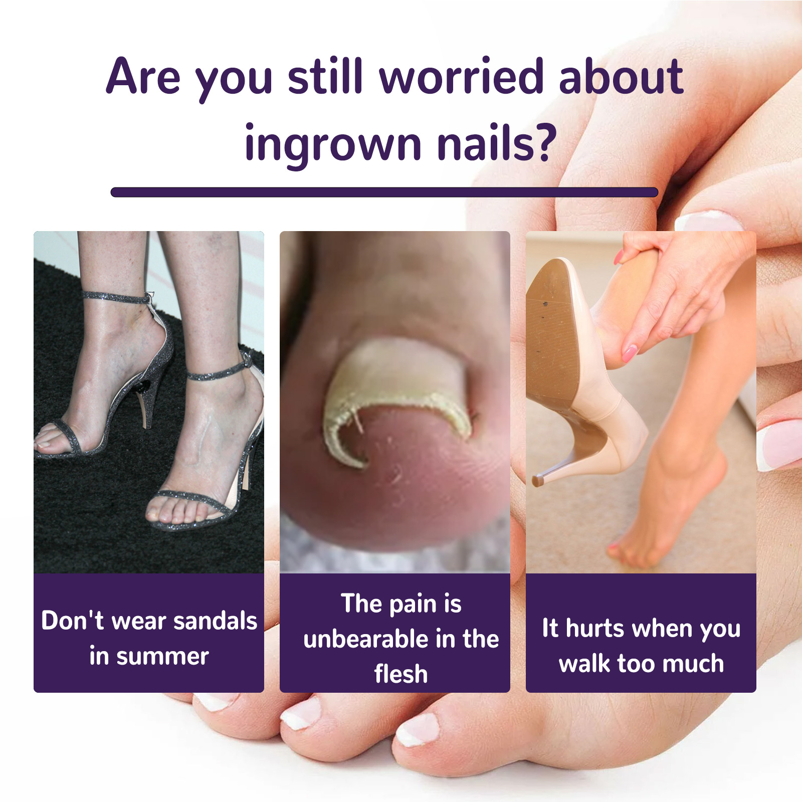 Elastic Toenail Correction Patch, Nail Groove Correction Nail Repair Ingrown Nail Patch - Afbeelding 4
