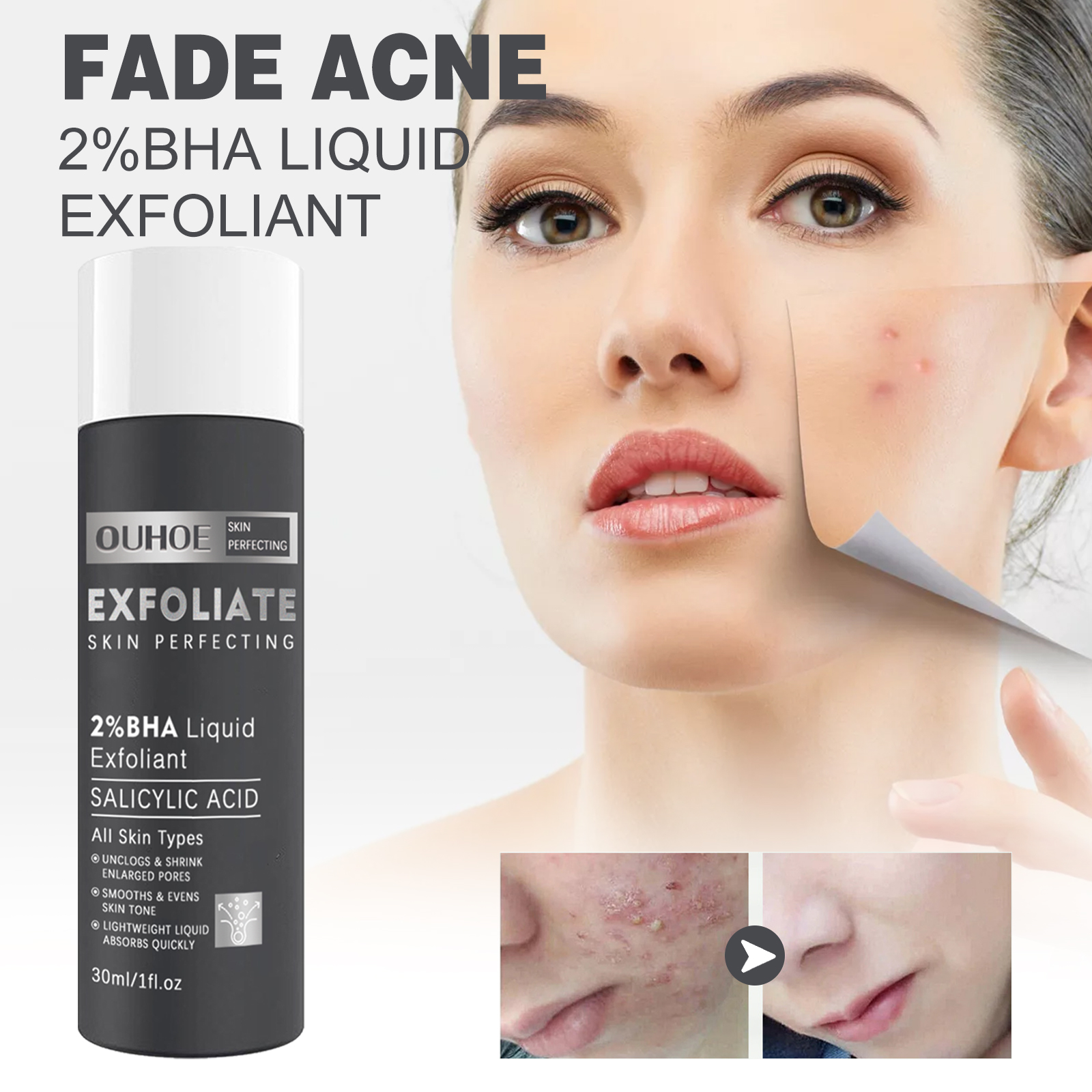 OUHOE Salicylic Acid Essence Hydrates And Moisturizes Soft And Delicate Skin And Face - Image 2