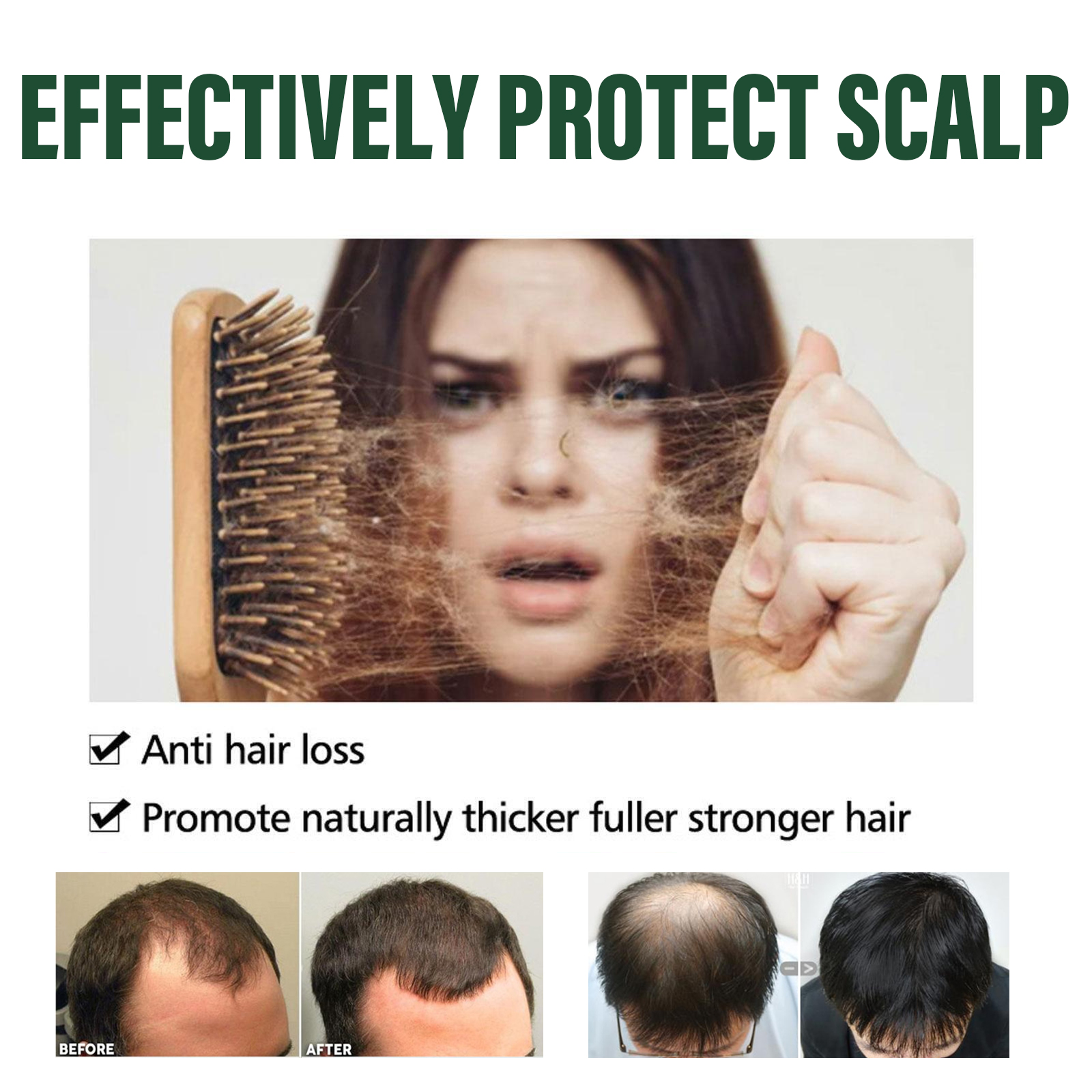 Amla Anti Hair Thinning Shampoo, Scalp Cleanness Moist Smooth Shiny Hair, Dense Hair Wash Protect Suits - Image 4