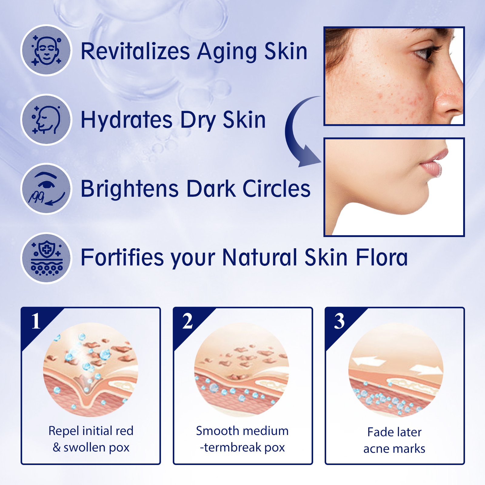 EELHOE Anti-aging Vitamin C Facial Essence, Reduces Spots Acne Fine Lines, Moisturizes Facial Essence - Image 5