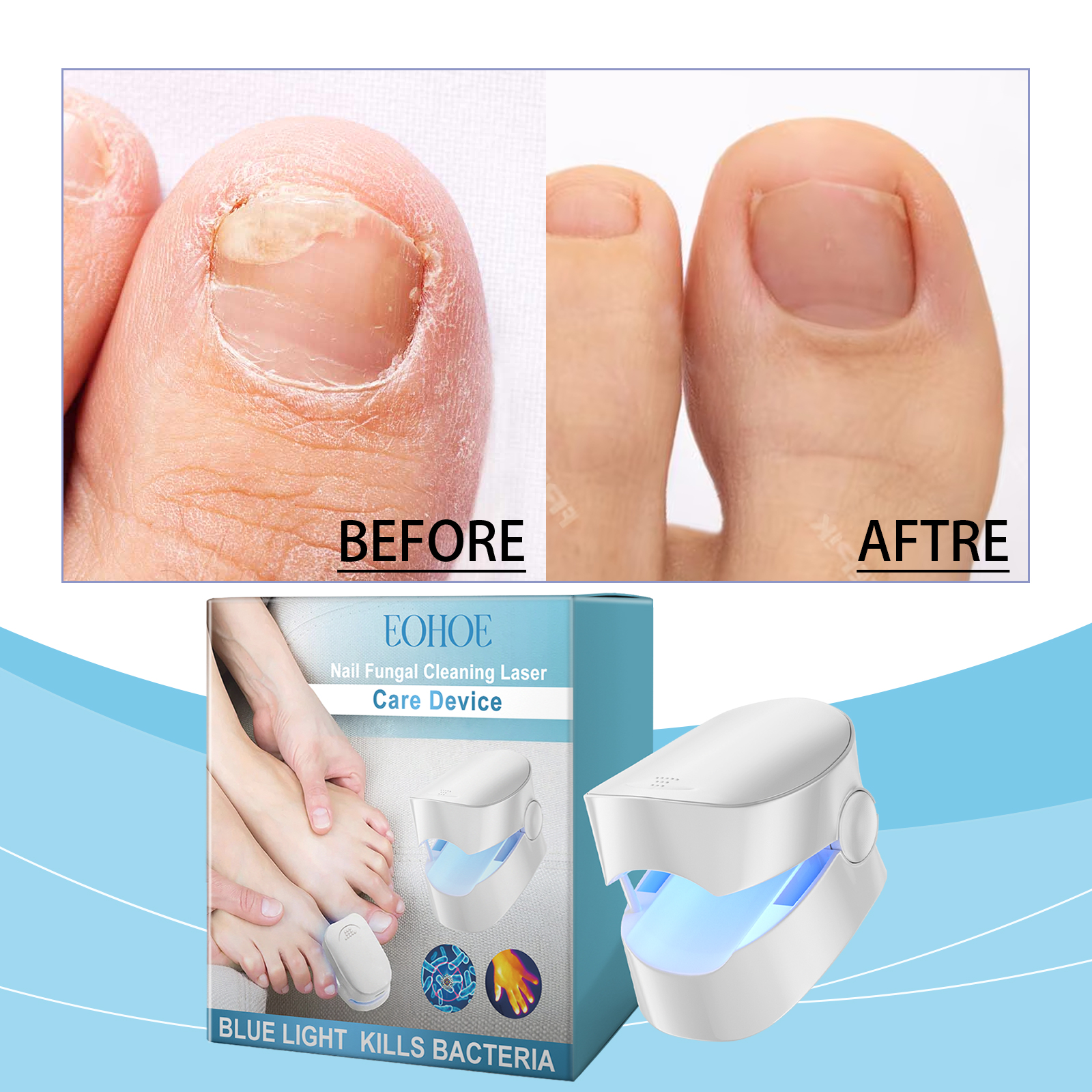 EOHOE Nail Care, Nail Cleaning Care To Relieve Discomfort On The Foot Of The Nail Smooth Rough Surface Of The Nail - Afbeelding 2